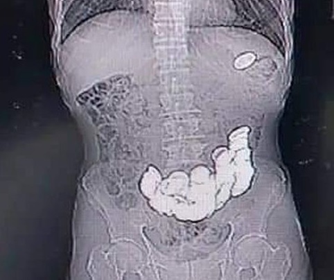   ,   , , ,  , 
