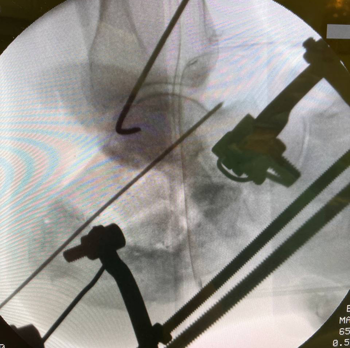 ������������� ��� ����� ��������������� ������� ��������.