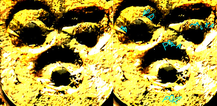  "", " "         . Sever Leopold. 2003