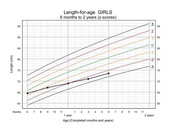 z-оценка роста девочки от 6 месяцев до 2 лет