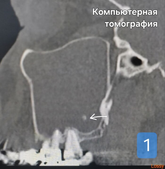      , , , , , -,   , ,  ,  , 