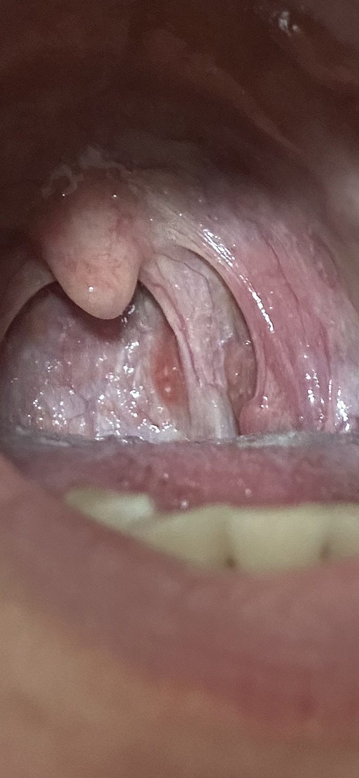 , ? , , 