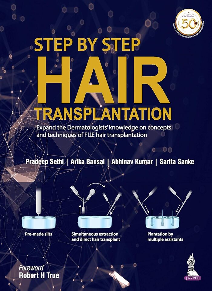 Step by Step Hair Transplantation:   .        ?, , ,  ,  , , , 