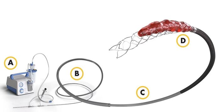   Trevo XP Pro Vue (Stryker)