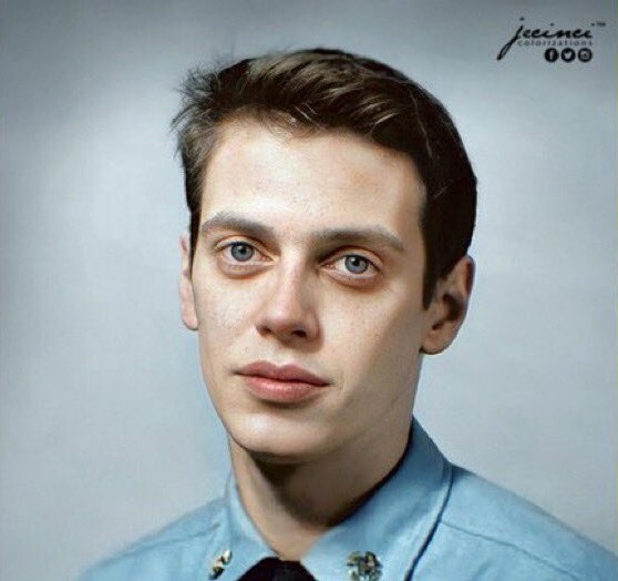 Высокая асимметрия глаз и рта, длинная носогубная борозда, выпуклые глаза, неравные трети лица, отклонение от усредненных пропорций, несимметричные черты, нарушенный баланс челюсти и скул.