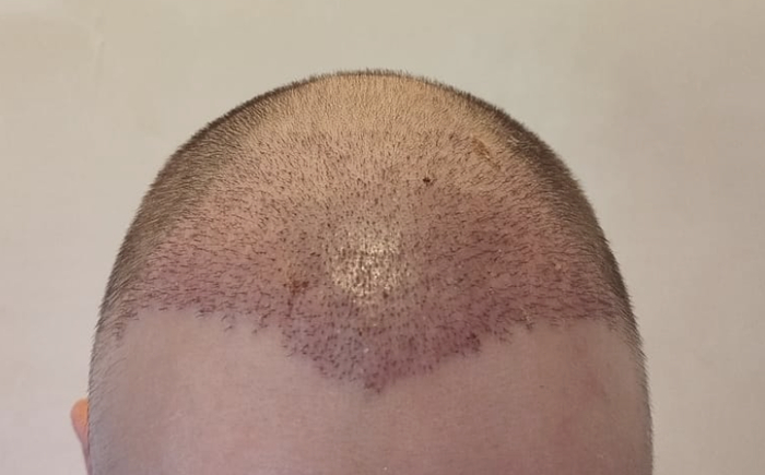   10        ,      