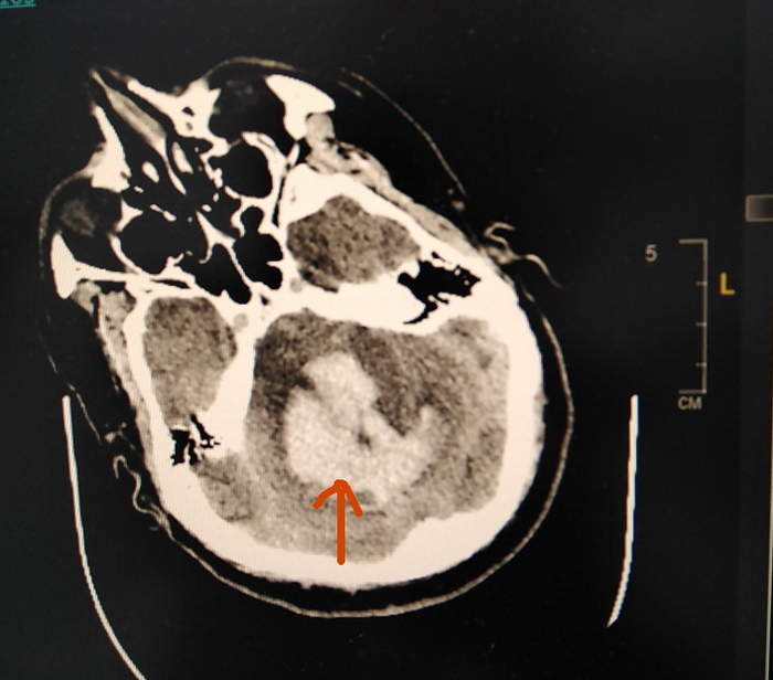 ������� ���������� �� �������, � ������� ��������� ������������� (������� ����� �����).