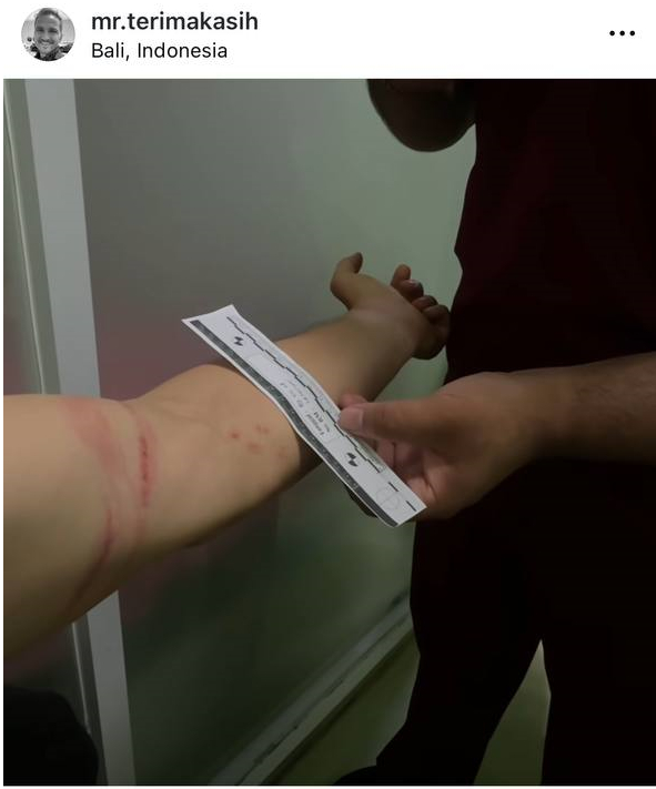 Сергей снимает побои в полицейском участке