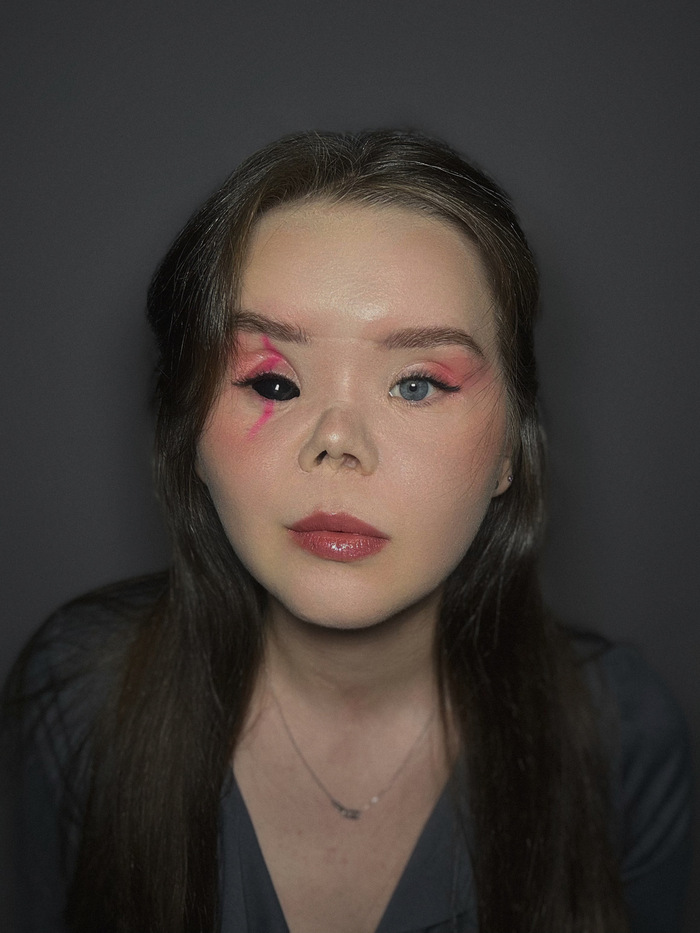 А чо с глазом?