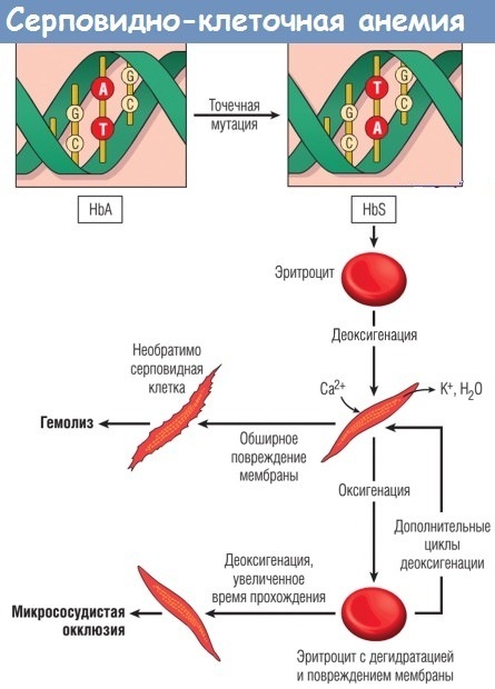 Механизм действия серповидно-клеточной анемии.