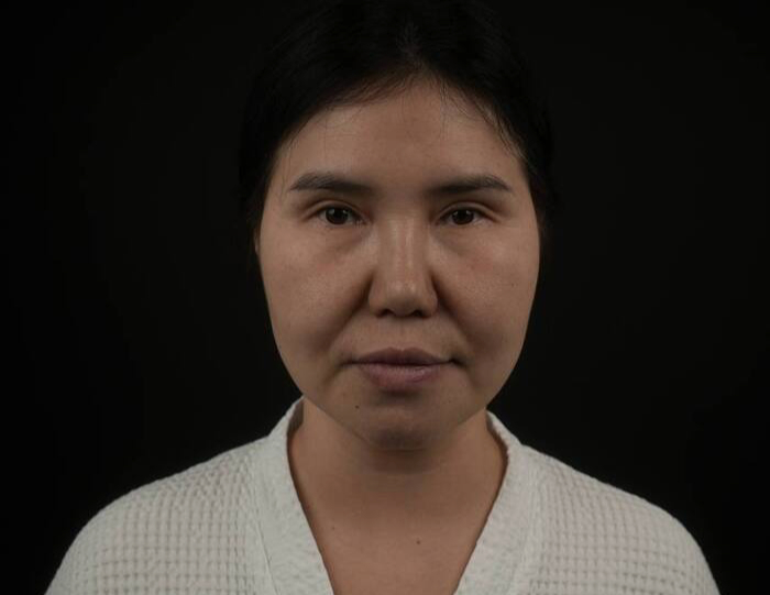 до операции