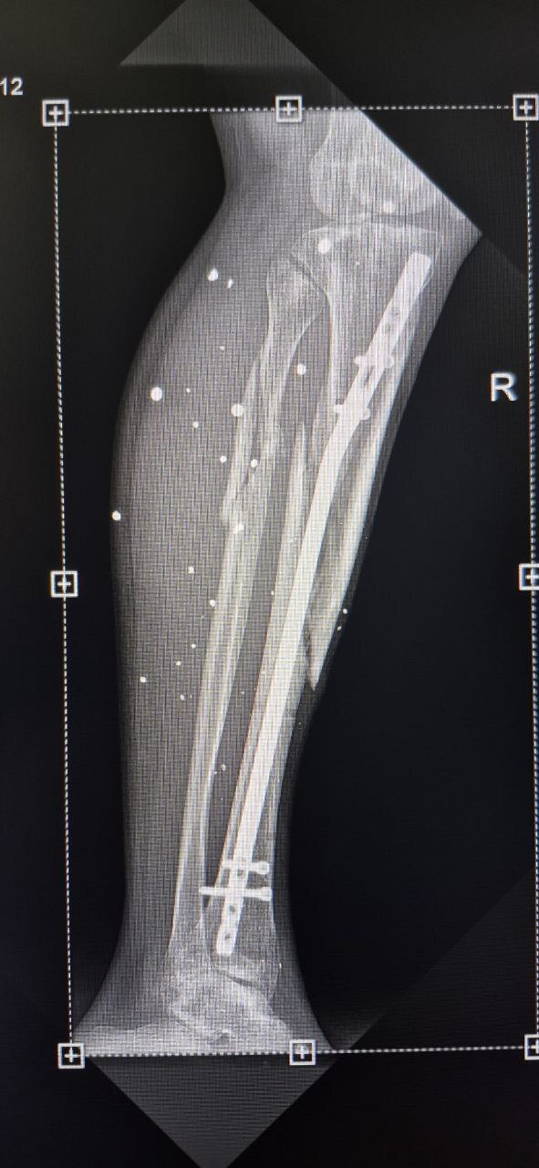 ����� ������ ������������!!!