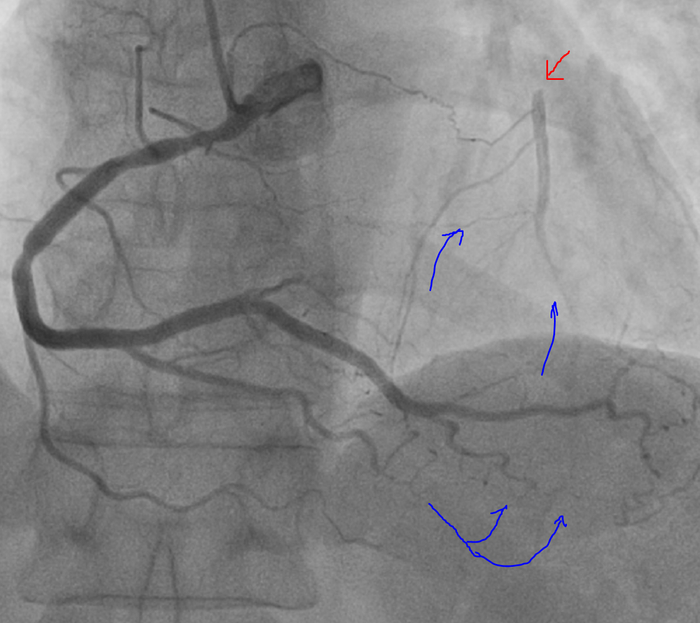  ,       ,       ( ).      -  ,    .