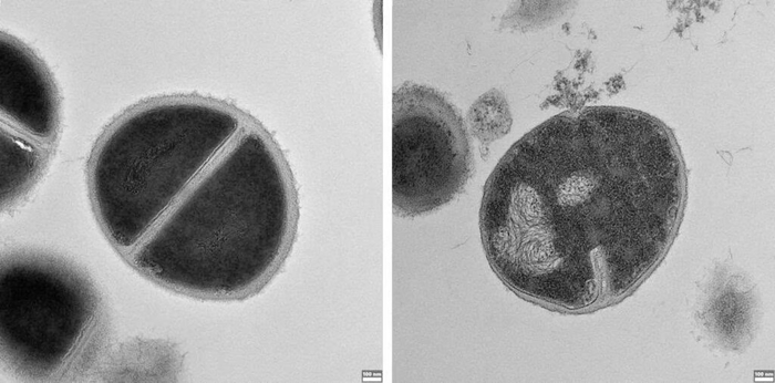 Посев клетки здорового микроба и клетка микроба, уничтоженная антимикробными пептидами, образующимися в протеасоме и обнаруженными в ходе исследования (Фото: институт им. Вейцмана)
