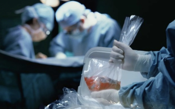 Мужчина умер от бешенства, которым заразился от пересаженной донорской почки