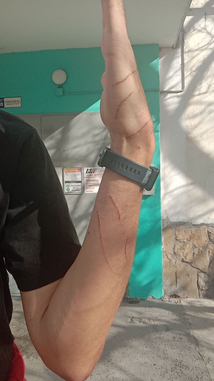 Но благо это самый эпичный базовый урон, который нам показывала Киряна 😁