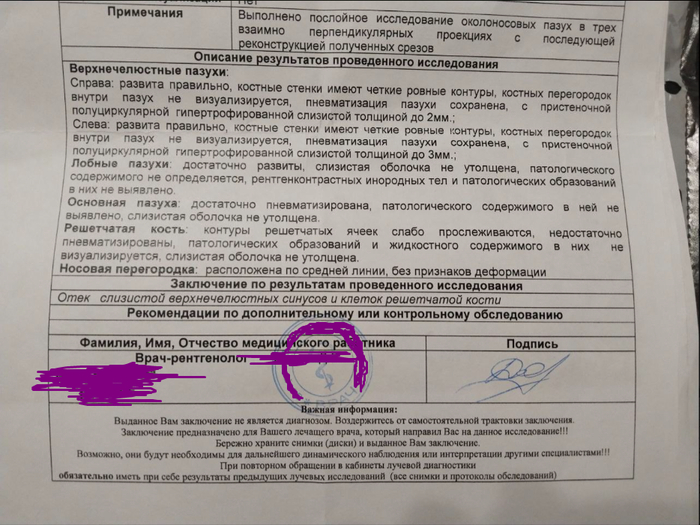 Как слезть с сосудосуживающих капель (бонусом облегчить сезонную аллергию и узнать про связь капель с работой сердца) ч.1