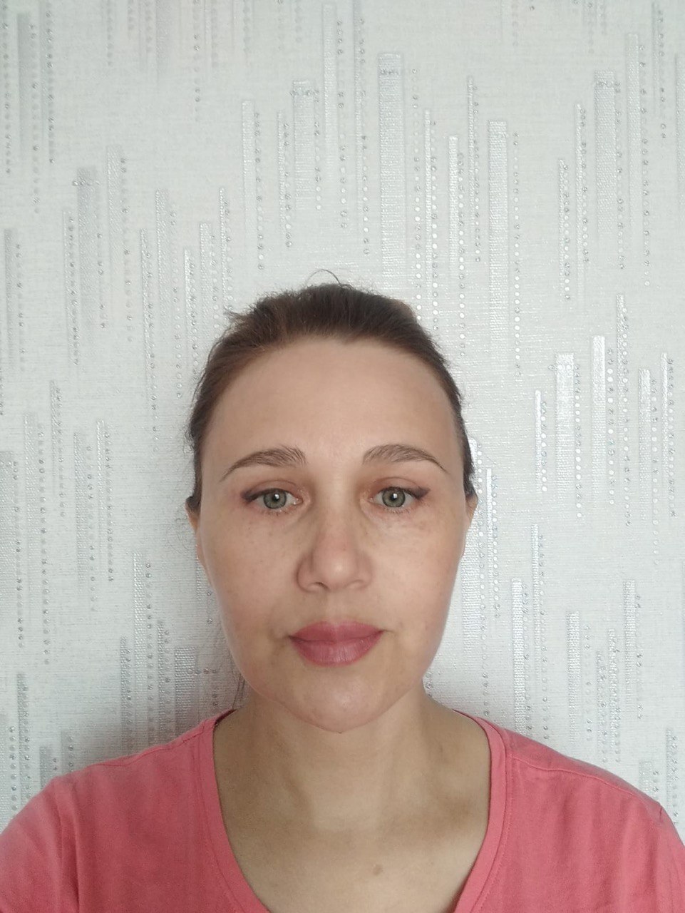 How to restore your original face without signs of overtightening? - My, Face, Facelift, Blepharoplasty, Video, Vertical video, Short videos, Longpost