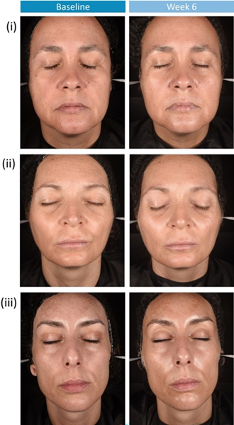 <a href="https://pmc.ncbi.nlm.nih.gov/articles/PMC12033157/" target="_blank" rel="nofollow noopener">Источник</a>