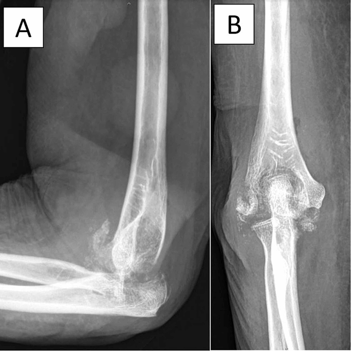 ���������� ����� ��� ������������� �������.