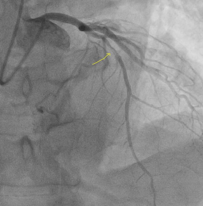 ������� ����� ���������� �������� ������� + ����� ����� �������