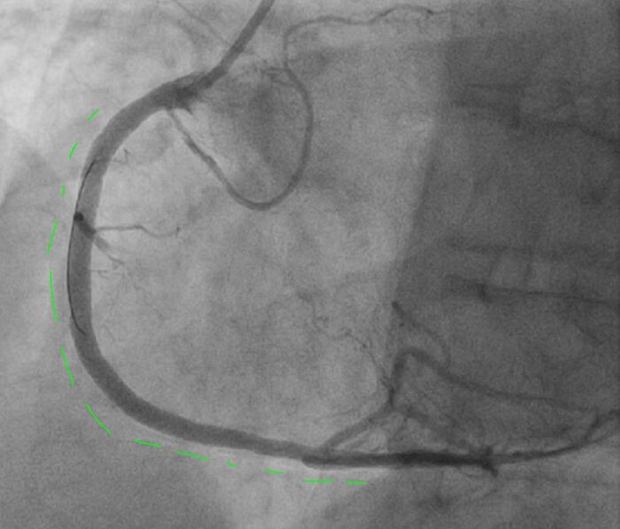 ����� + �����