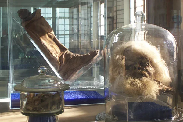 Голова сохранилась полностью, но тело находится в виде обломков костей в сосуде рядом