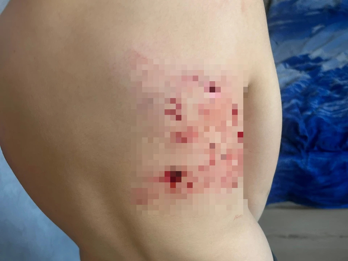 ����: ���������� ��������