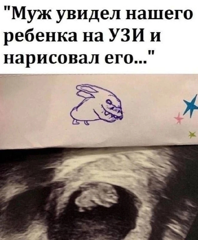 УЗИ