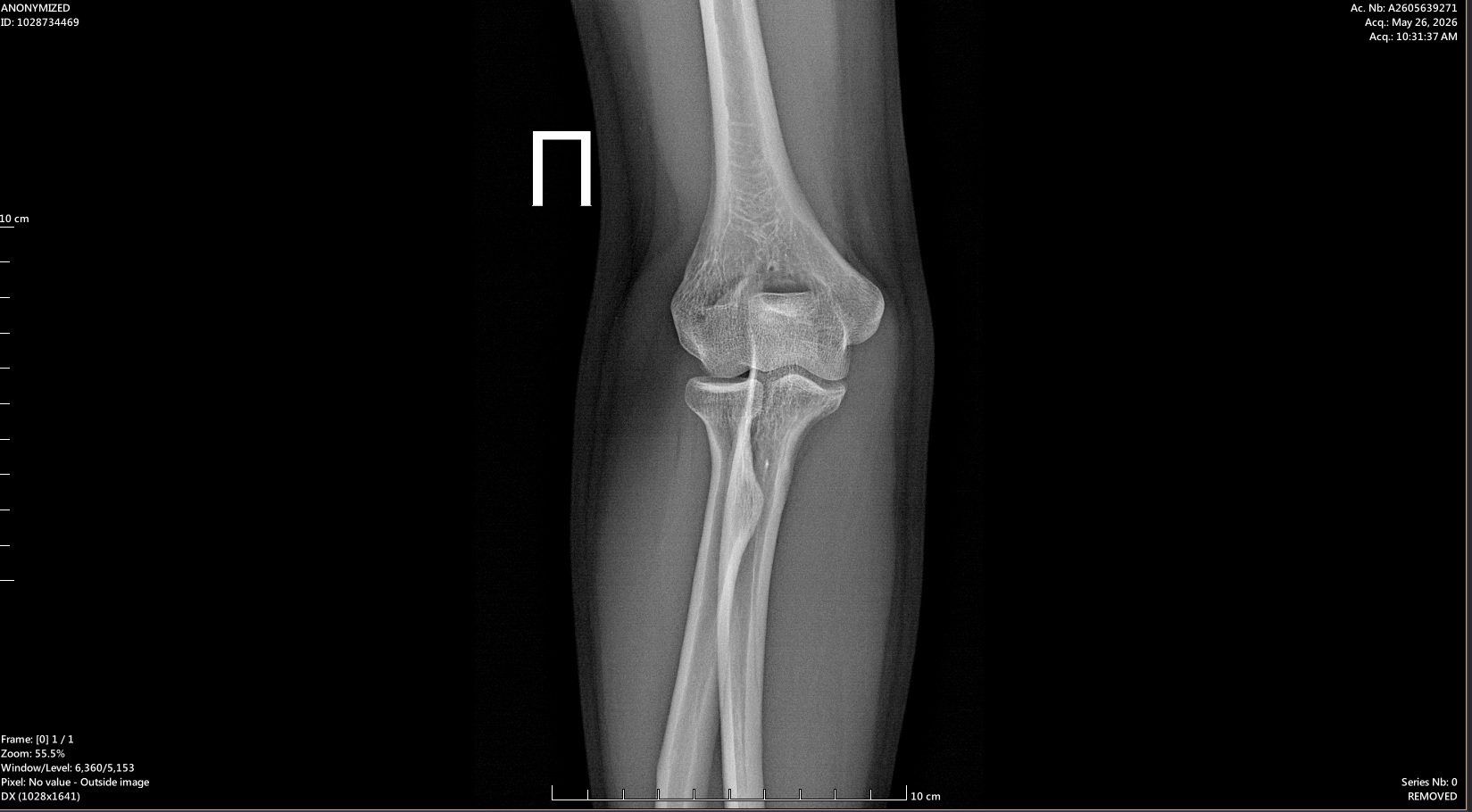 Need medical help! - My, Injury, The patients, Disease history, Arthrosis, Longpost