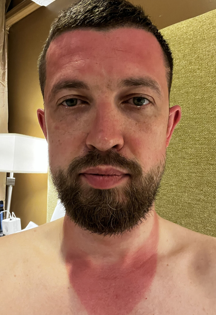 �� ���������� ���� ������, � ������� ��� ����������� ���� � SPF 50+. �������� ����� ������ �� ���� � ���� (�� ��� � ����� ������ - ������ �����). ��� �� ���� �����, ��� � ����� ����� ���� ���� �����