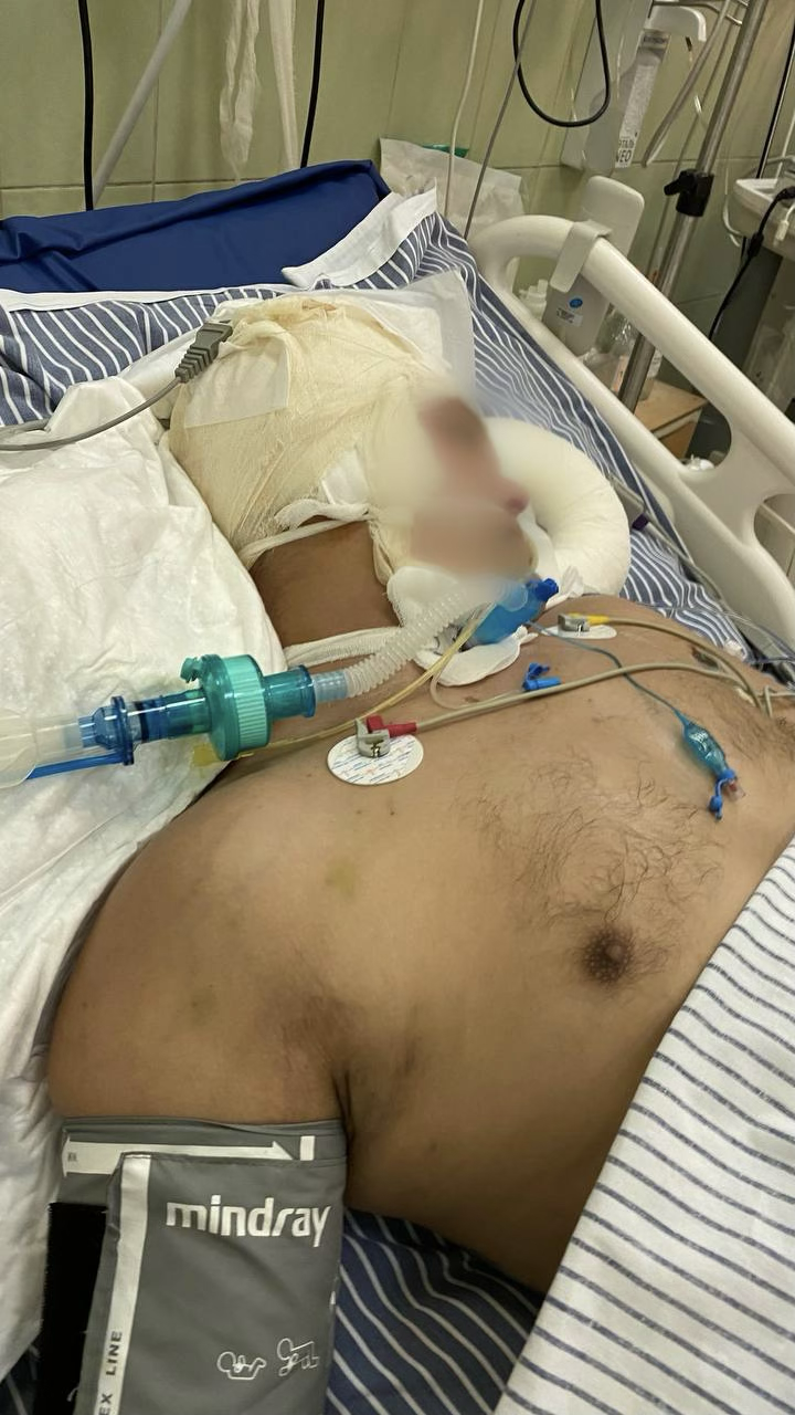 I won't give up and I won't let you or the story of the fight for my husband's life. The Wives Project - Series Project Wives, My, Longpost, Wife, Russian spirit, Regina, Disease history, Injury, Treatment, Surgery, Operation, Video, Vertical video, Short videos, Rutube