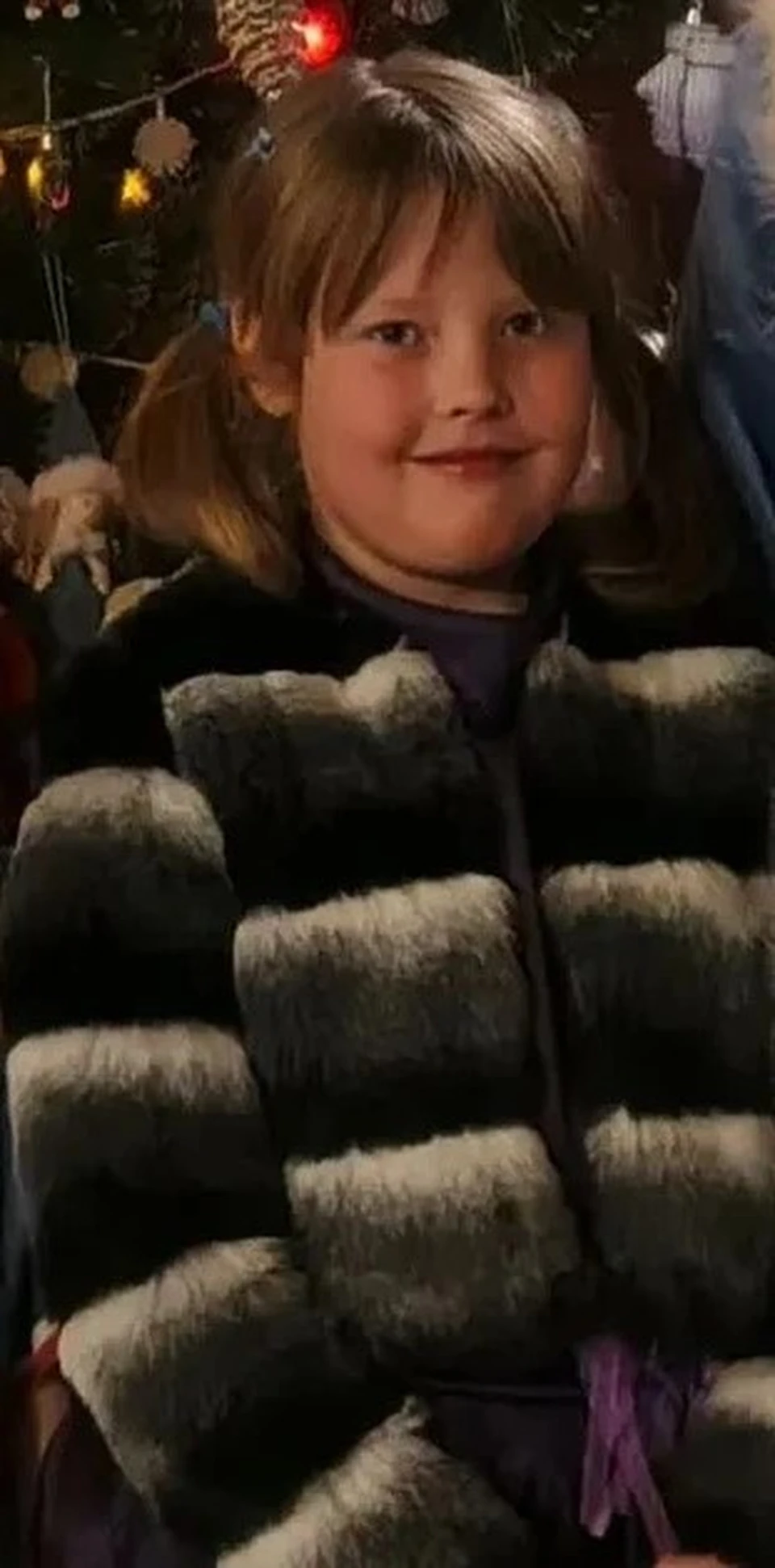 We thought it was just a runny nose: An 8-year-old girl from the Irkutsk region is battling a rare disease. - My, Disease history, Disease, Irkutsk, Rare diseases, Operation, Surgery, Longpost